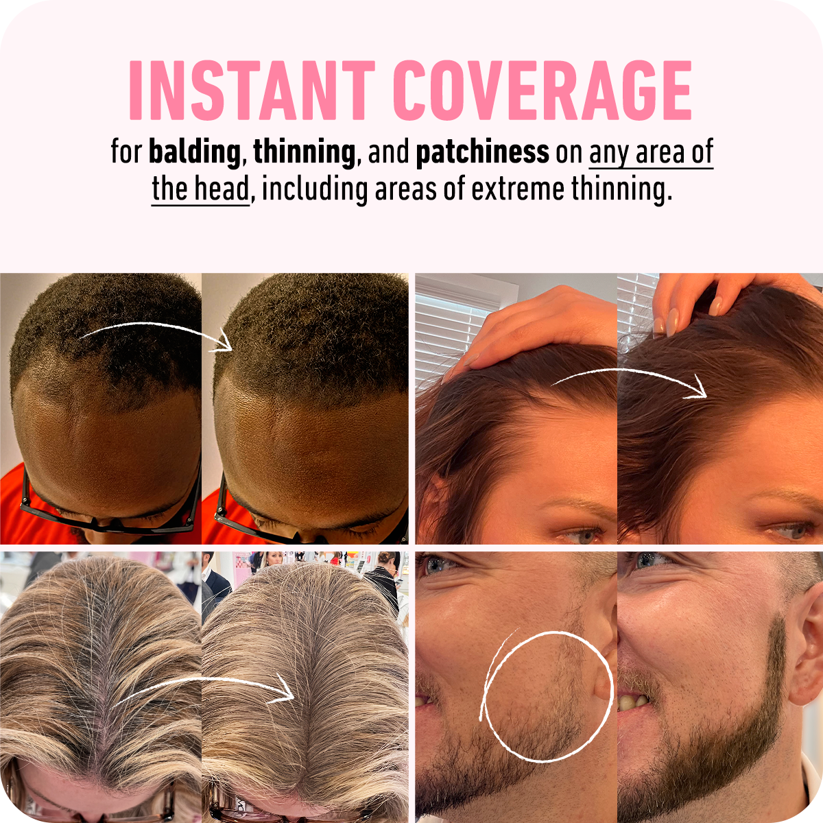 Magic Hair - Instant Result