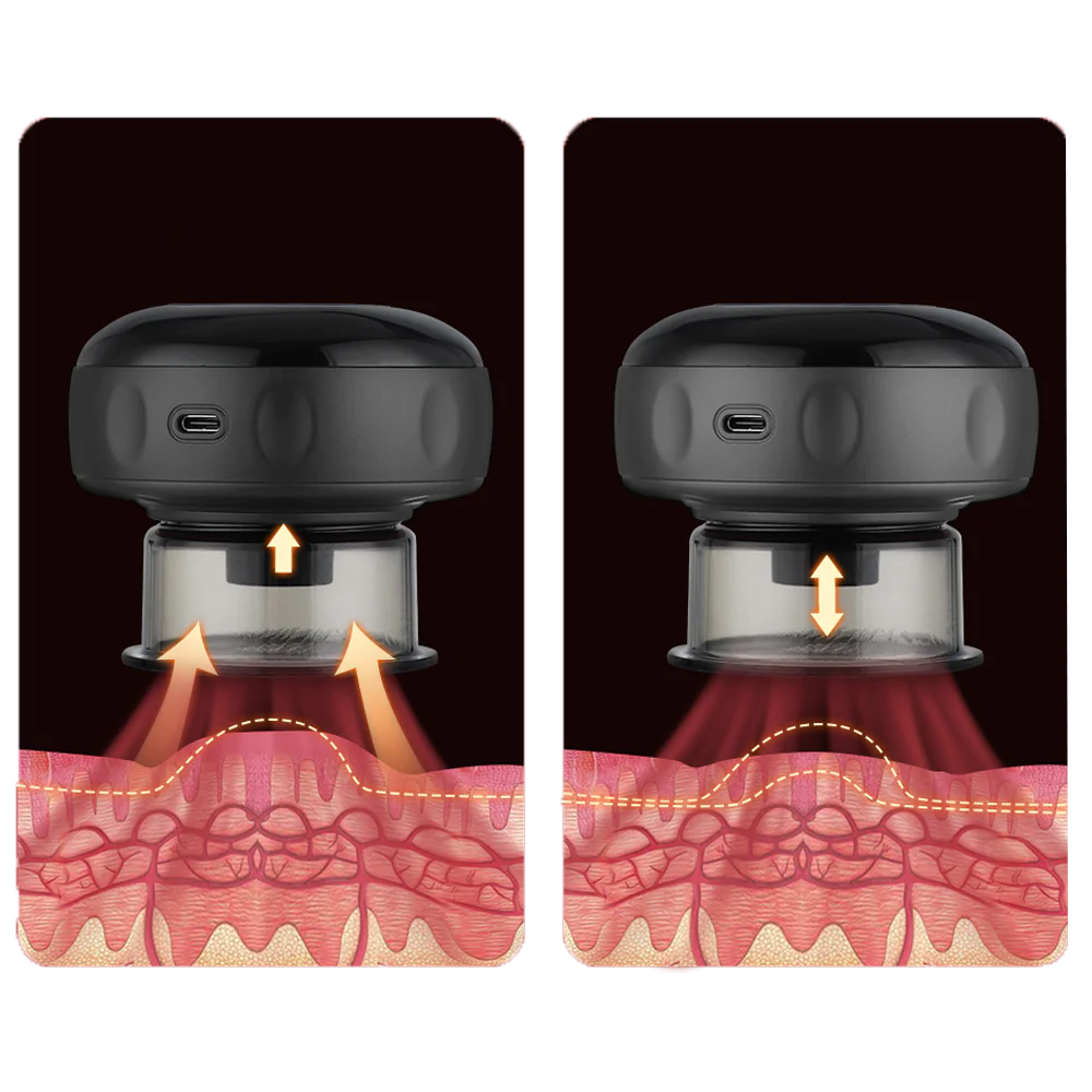 Smart Cupper Detox™
