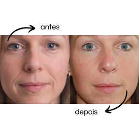 Flex Beauty - Reusable Patches of Silicone
