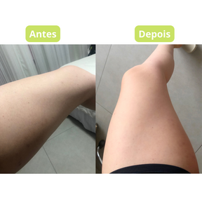 Perfect Skin Whitening Cream
