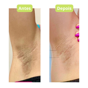 Perfect Skin Whitening Cream