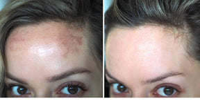 Perfect Skin Whitening Cream
