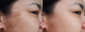 Perfect Skin Whitening Cream
